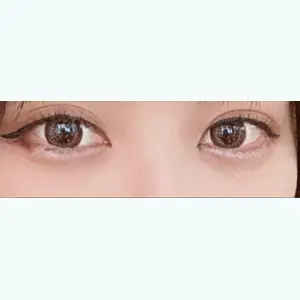 東京シンデレラ美容外科の口コミ