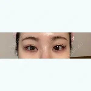 東京シンデレラ美容外科の口コミ