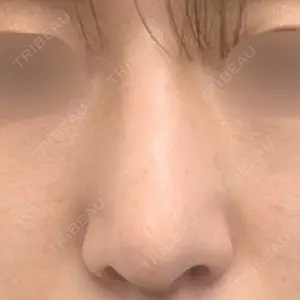 MIL CLINIC OSAKAの岩脇 槙佑医師口コミ