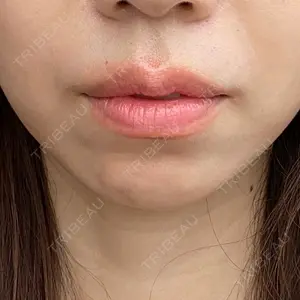 東京シンデレラ美容外科の口コミ
