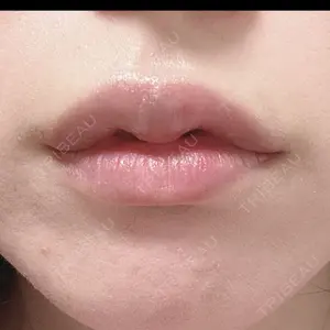 2 days after image
