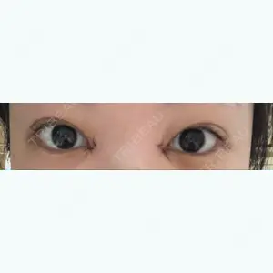 AI Beauty Clinic （エーアイ美容クリニック）の尾崎 宥文医師口コミ