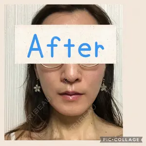 60 days after image