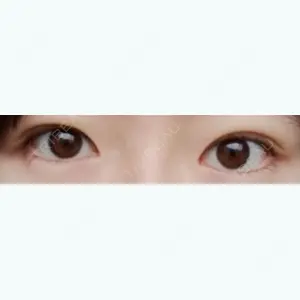 30 days after image