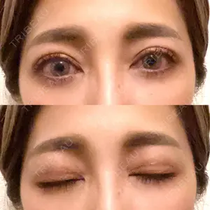 秋葉原美容クリニック口コミ