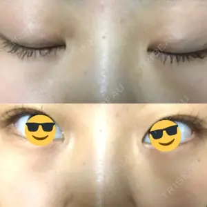 48 days after image