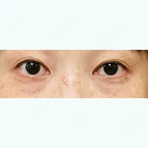 TCB東京中央美容外科 TCB東京中央美容外科 仙台駅前院口コミ
