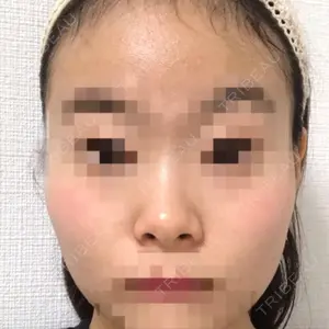 37 days after image
