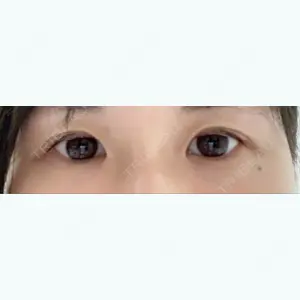 1199 days after image