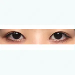 口コミ