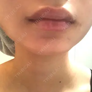 渋谷美容外科クリニック 新橋院の藏薗 侑人医師口コミ