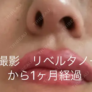 東京形成美容外科 船橋院の弓削田　浩主医師口コミ
