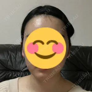71 days after image