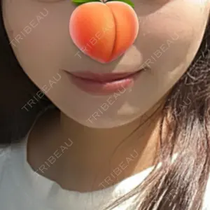 Zetith Beauty Clinic 銀座院口コミ