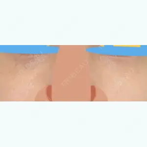 有楽町美容外科クリニック口コミ