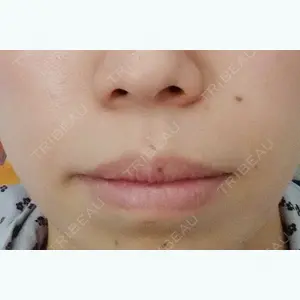 YBC横浜美容外科 YBC横浜美容外科 大宮院口コミ