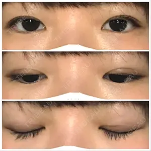 42 days after image