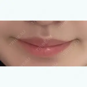 口コミ