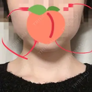 湘南美容クリニック渋谷アネックス院の平田玲奈医師口コミ