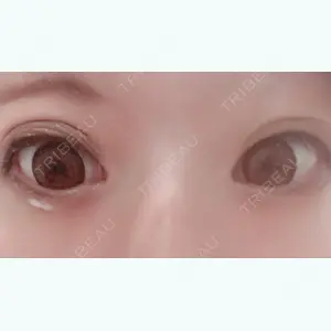 before image