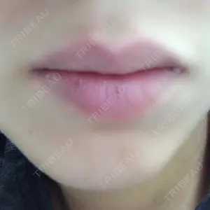 before image