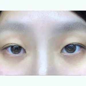 before image