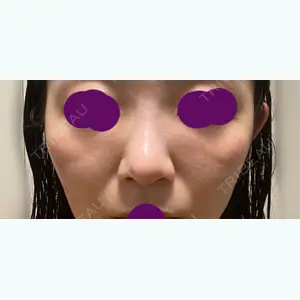 口コミ