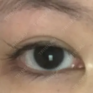 before image