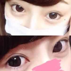 before image