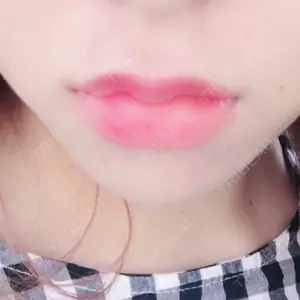 口コミ