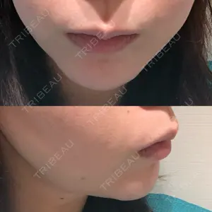 before image