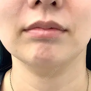 MIL CLINIC OSAKAの岩脇 槙佑医師口コミ