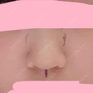 before image