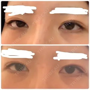 before image
