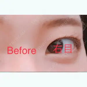 before image