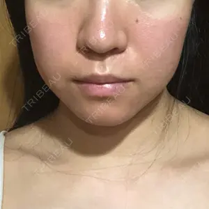 id美容外科の口コミ