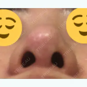 before image