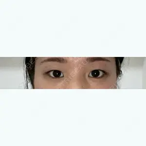 大阪 雅 -miyabi- 美容外科の川端 久雅医師口コミ