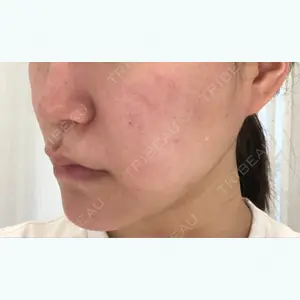 藤・ナチュレ美容クリニック 藤ナチュレスキンクリニック口コミ