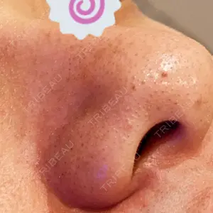 藤・ナチュレ美容クリニック 藤ナチュレスキンクリニック口コミ