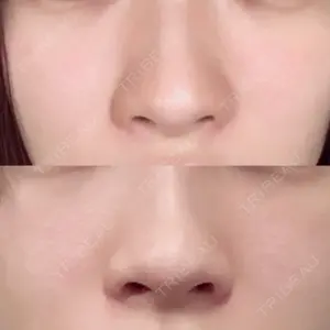before image