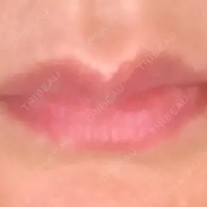 before image