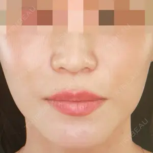 TAクリニック 福岡TAクリニック口コミ