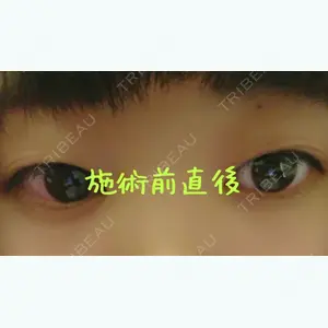 before image