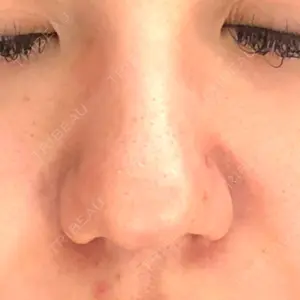 before image