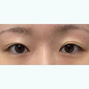 ルネッサンス美容外科医院の口コミ