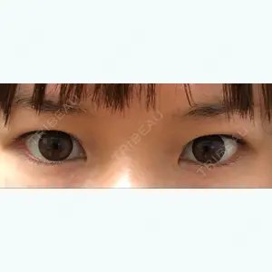 before image