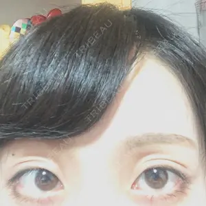 before image
