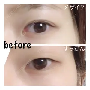before image