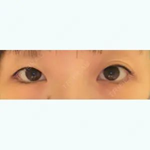 口コミ